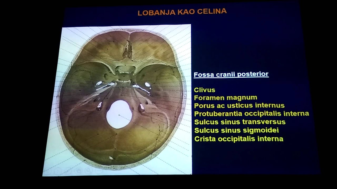 kosti lobanje 1