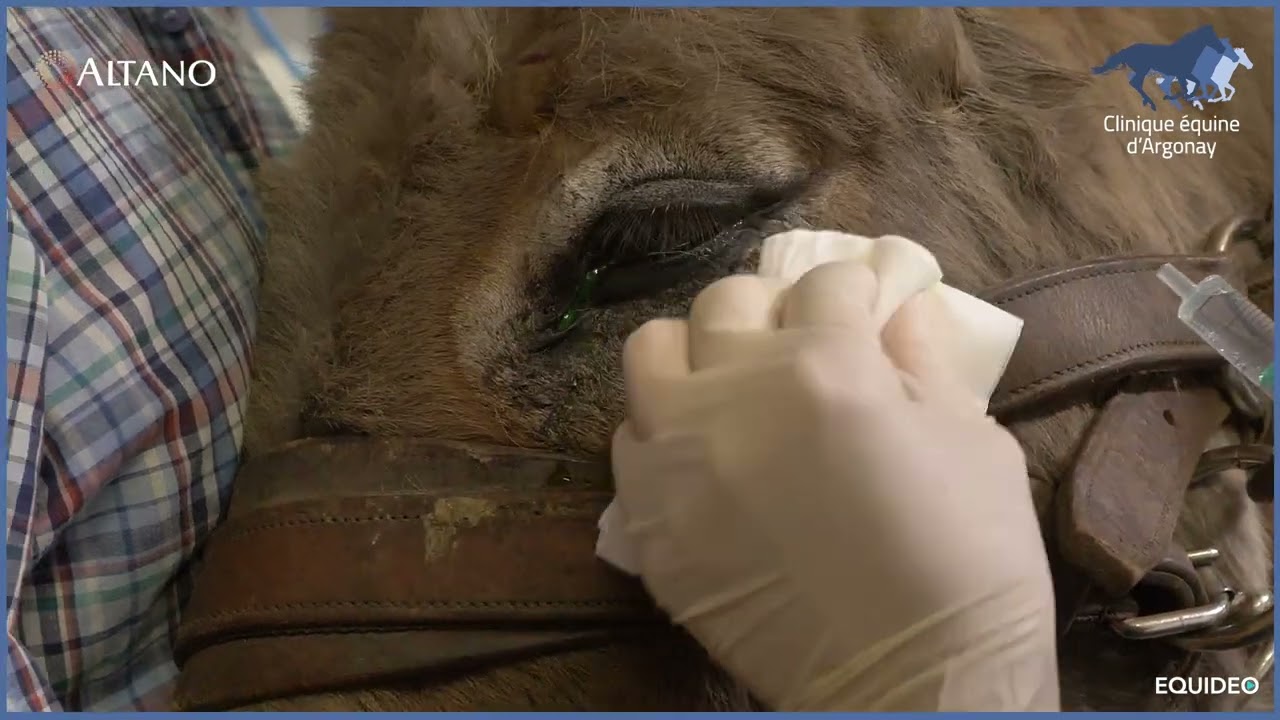 ARGONAY ULCERES UVEITES HD FR