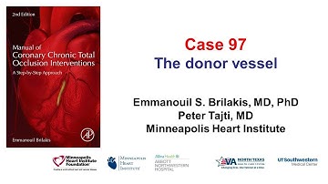 Case 97: Manual of CTO Interventions: The Donor Vessel