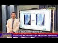 20260728 #外傷後怎麼痛那麼久？談不可輕忽的骨挫傷 bone bruise—大北門新聞網