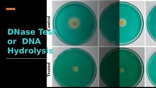 2420 Biology Lab Gelatin Hydrolysis, DNA Hydrolysis and Lipid Hydrolysis