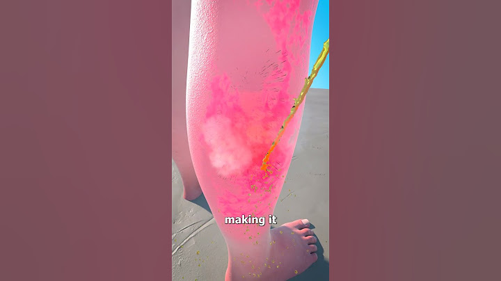Don't Pee On A Jellyfish Sting 😯