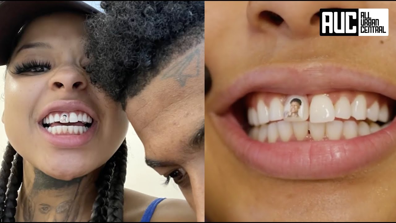 Blueface Girlfriend Gets His Face On Her Permanent Tooth 