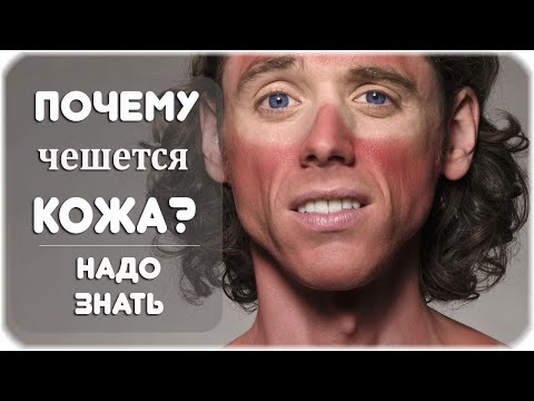 Почему после загара чешется кожа?