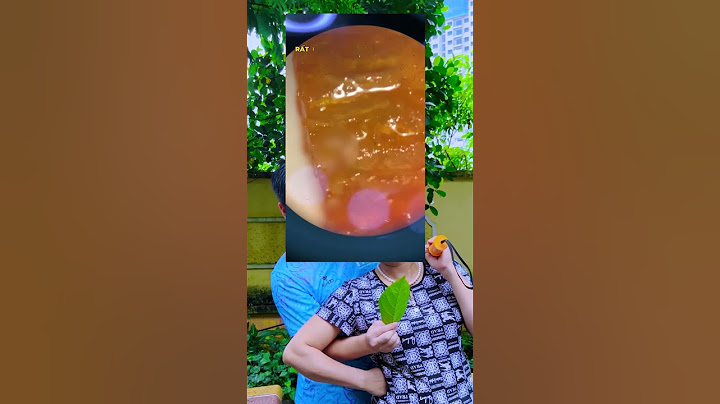 Đồ ăn của ĂN CÙNG BÀ TUYẾT soi ở kính hiển vi sẽ như thế nào! phần 1