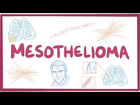 Mesothelioma - causes, symptoms, diagnosis, treatment, pathology