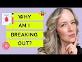 Why Am I Breaking Out All Of A Sudden QUESTIONS TO ASK YOURSELF IF YOU RE BREAKING OUT