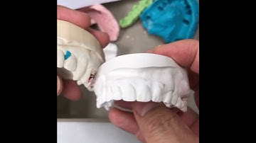 Traditional partial design