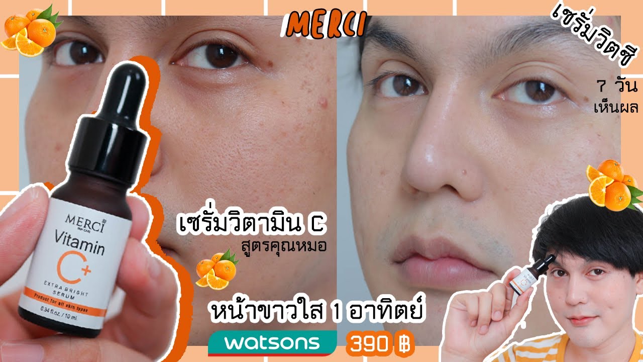 ♡ รีวิว ’ : เซรั่มวิตซี Merci หน้าขาว ใส 7 วัน เห็นผล✨🍊 เซรั่มวิตามิน C สูตรคุณหมอ 390 ฿ | จบบ ♡