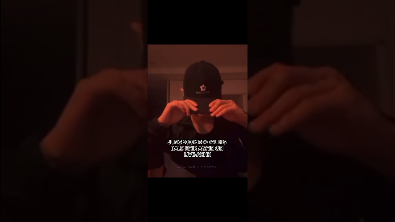 He's bald yo guys🤣😭🤌🏻 