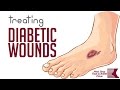 Treating Painful Diabetic Wounds and Ulcers
