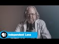 Jim Allison's Breakthrough and Challenges