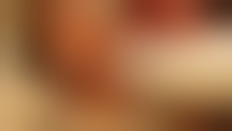 SCALP Components Surgeons Danger Layer Temporoparietal Fascia Clinicals – Sanjoy Sanyal – Proceum