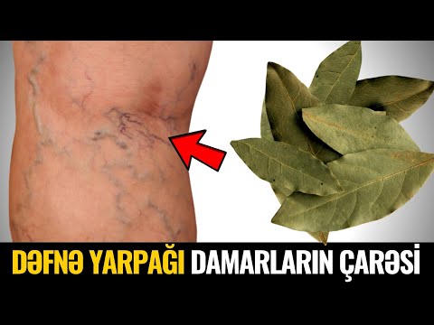 Video: Dağ dəfnəsi hansı rəngdədir?