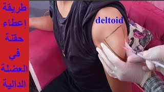 تعلم إعطاء حقن العضل وحقن التطعيم في العضلة الدالية deltoid muscle #احمد_مؤرخ_التاريخ