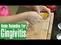 GINGIVITIS Treatment At Home | How To Get Rid Of GINGIVITIS