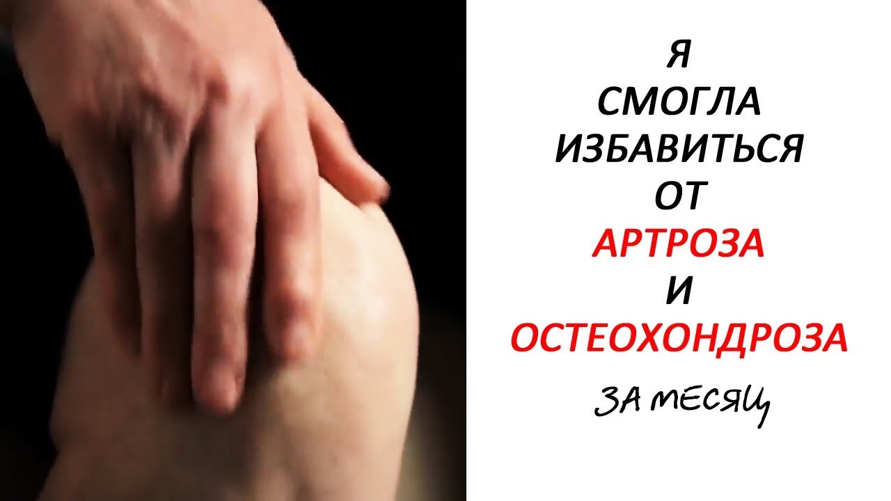 Я СМОГЛА ИЗБАВИТЬСЯ ОТ АРТРОЗА И ОСТЕОХОНДРОЗА ЗА МЕСЯЦ! #артроз # ...