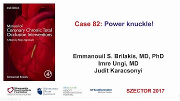 Case 82: Manual of CTO Interventions: BASE (balloon-assisted subintimal entry)