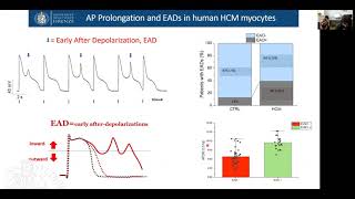 Clinical implications of cardiomyocyte electrophysiological remodelling in HOCM