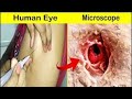 98% लोग नहीं जानते | Human Skin Under Microscope | microscopic things