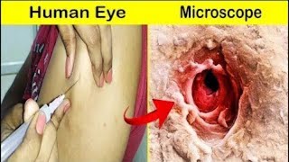 98% लोग नहीं जानते | Human Skin Under Microscope | microscopic things