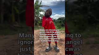 Many are choosing to ignore this little angel just because hecwas born without arms yet you choose