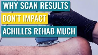 Achilles Tendonitis Treatment - Pain vs. Scan Results