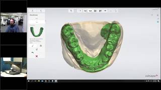 Digital Dentistry Training Series: Scan and Design Splints