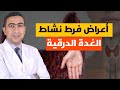 اعراض فرط نشاط الغدة الدرقية ١٢ علامة تحذيرية
