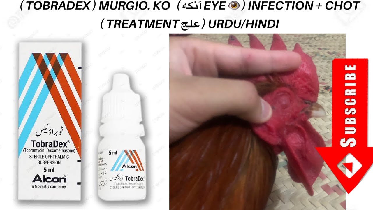 ( TOBRADEX ) MURGIO. KO ( آنکه EYE 👁 ) INFECTION + CHOT ( TREATMENT علج