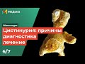 ЦИСТИНУРИЯ - камни в почка / генетика, патогенез, лечение / USMLE step 1 5/7