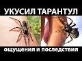 Укусил мизгирь (тарантул южнорусский)