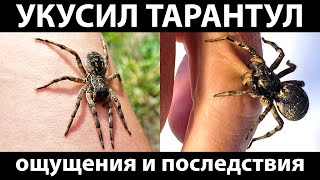 Укусил мизгирь (тарантул южнорусский)