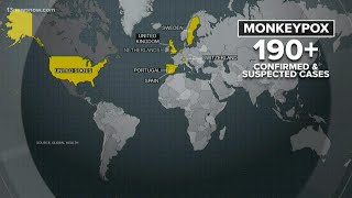 Monkeypox spreading across the world, several cases in US