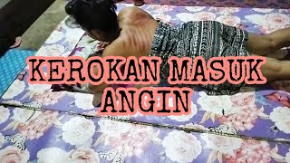 Kerokan Masuk Anginantika 