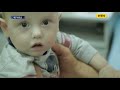 Дивовижну операцію хлопчику з вагою всього 950 грамів провели медики у Чернівцях