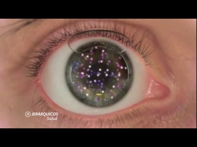 Todos los videos