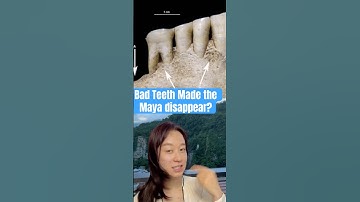 Bad teeth cause the Maya disappear??