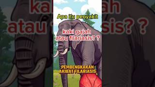 Apa itu Penyakit Kaki Gajah Atau Filariasis ?? 😱