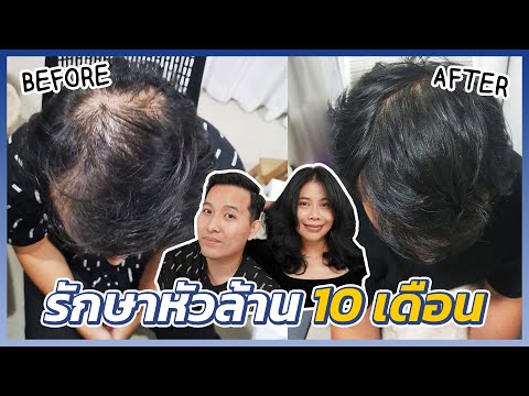 วีดีโอ: 10 วิธีในการเป็นผู้หญิงหัวล้านและสวย