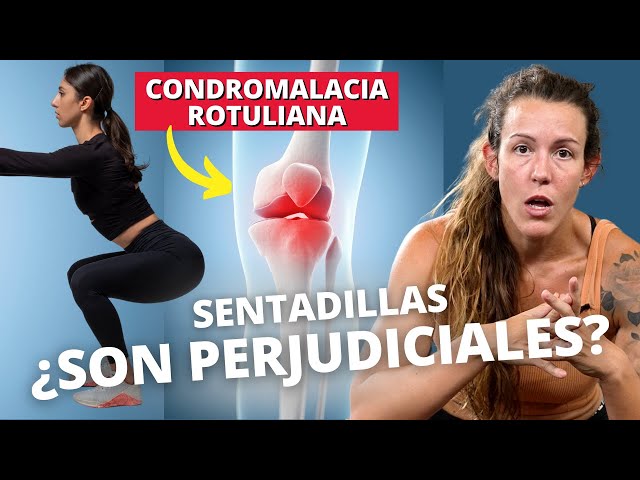 Condromalacia y Dolor de Rodilla - Lo que NO SABES sobre las sentadillas -  YouTube