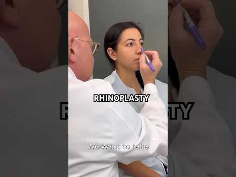 Video thumbnail: Rhinoplasty with Dr. Krau #drkrau #drarykrau #cosmeticsurgery — Dr. Ary Krau
