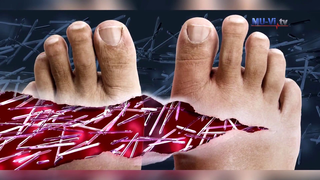 За контрола върху подаграта