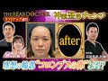 【リフトアップ】理想の輪郭は「コロンブスの卵」を提唱する博多の神業ドクターが魅せる若返り術 #湘南美容クリニック