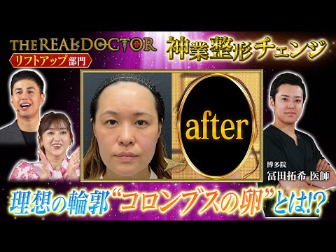 【リフトアップ】理想の輪郭は「コロンブスの卵」を提唱する博多の神業ドクターが魅せる若返り術 #湘南美容クリニック