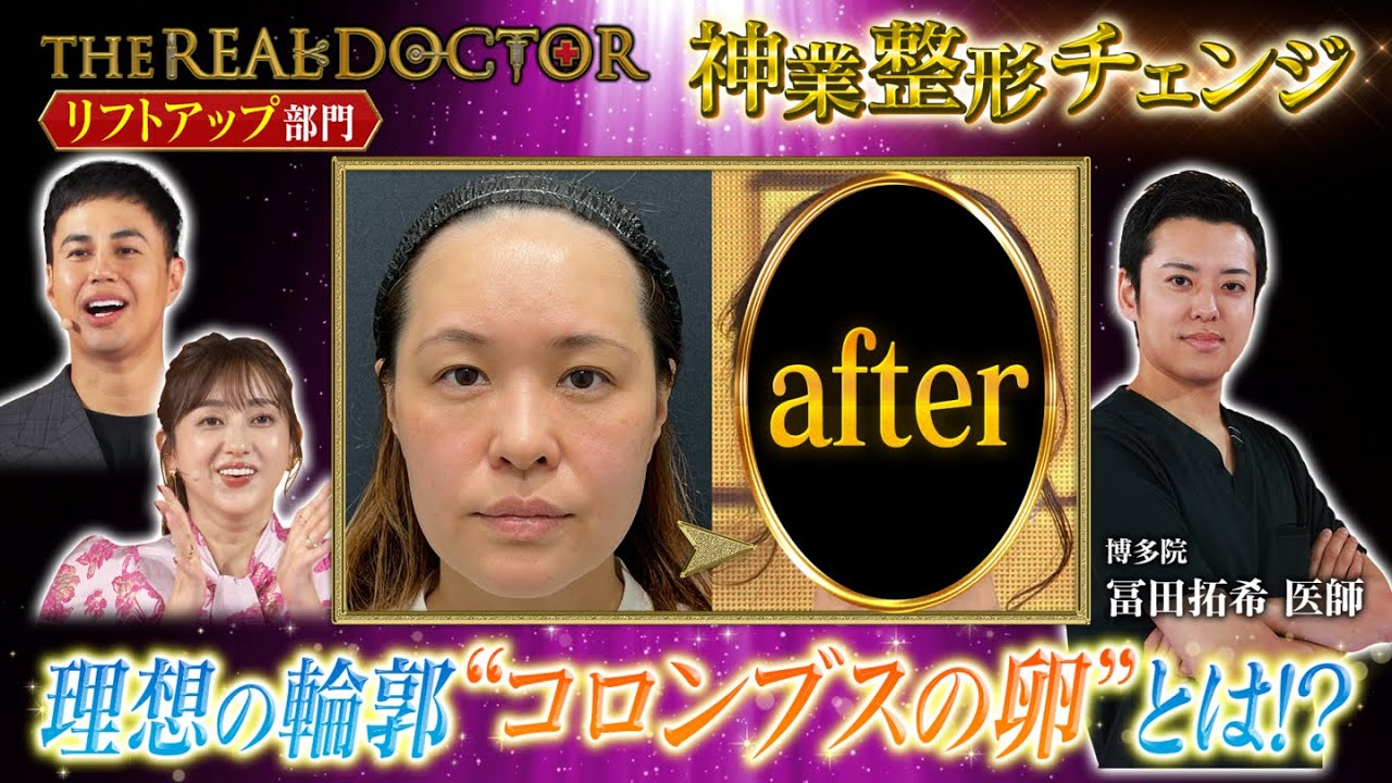 【リフトアップ】理想の輪郭は「コロンブスの卵」を提唱する博多の神業ドクターが魅せる若返り術 #湘南美容クリニック
