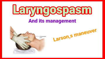 Laryngospasm and its management | Larson maneuver @anaesthesiawithbabar2576