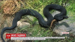 11-річного хлопчика літаком доправили до Харкова, аби врятувати від отрути гадюки