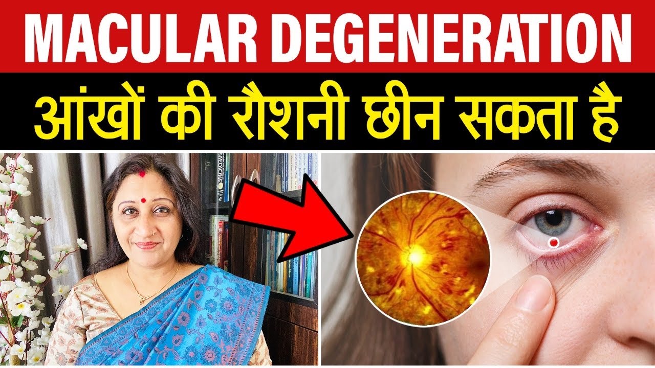 Macular Degeneration Treatment In Hindi By Acupressure Age Related