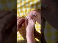 soft Silicone Toe Separator ! CorrectOverlapping Toes, Reduce Pressure &amp; Improve Foot Comfort